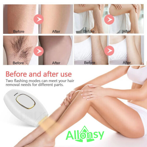 IPL Hair Removal Device for Body & Face